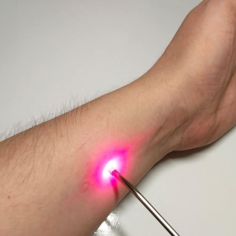 capa-acupuntura-a-laser