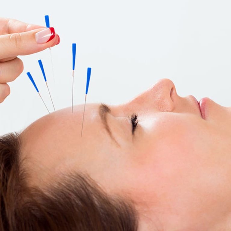 capa-acupuntura-estetica